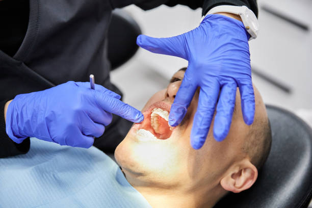 Best Broken or Chipped Tooth Repair in Garrett, TX